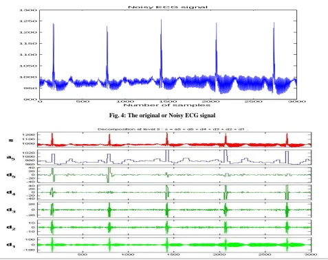 Fig. 4: The original or Noisy ECG signal 