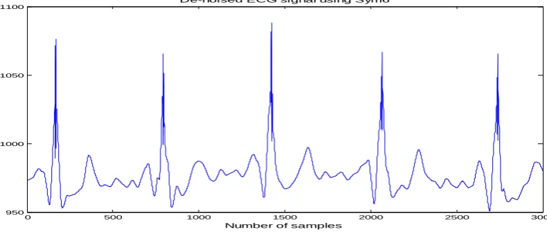 Fig. 6:De-noised ECG signal for nonwhite noise structure using Haar wavelet 