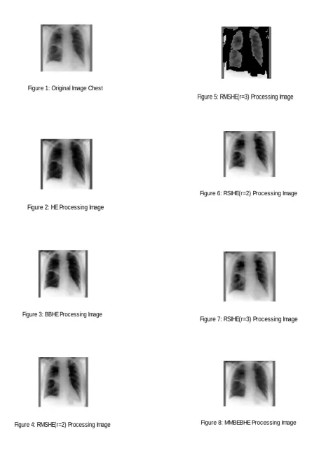 Figure 8: MMBEBHE Processing Image