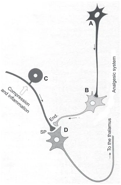 Figure 4 Scheme of the mechanisms for the control of algesic signals. By releasing endorphins (end.), the enkephalinergic interneuron may inhibit the presynaptic connection of a neurocyte (C) of a spinal ganglion, which, under compression of a herniated di