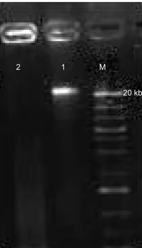 Figure 2 Plasmid profiles of different Enterococcus spp. strains.Note: lane M: marker.