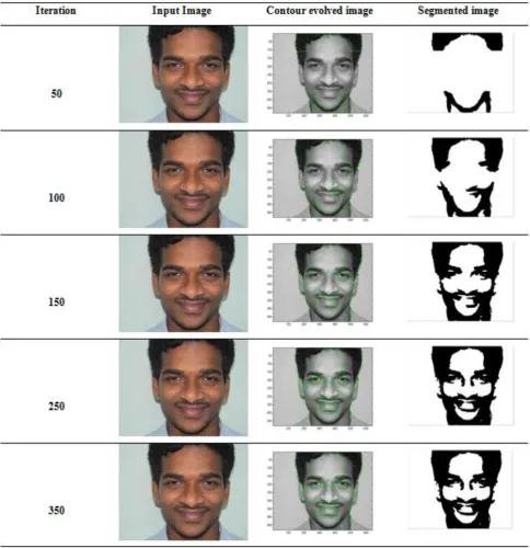 Fig 4: Results for different iteration levels and corresponding segmented images for test image 1