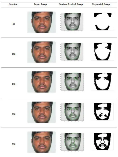 Fig 5: Results for different iteration levels and corresponding segmented images for test image 2