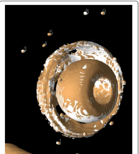 Fig. 4 Model displayed after registration. A 2-mm displacementlaterally has been introduced
