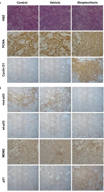 Figure S2 immunohistochemical staining of solid tumor tissue in an animal tumor model in Figure 5a.Notes: (A) h&e staining, Pcna and cyclin D1, (B) mut-p53, wt-p53, MDM2, and p21.Abbreviations: h&e, hematoxylin and eosin; Pcna, proliferating cell nuclear antigen; mut-p53, mutant p53; wt-p53, wild type p53; MDM2, mouse double minute 2 homolog.