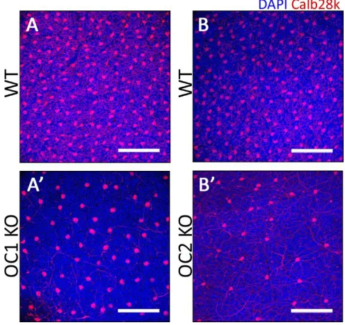 Figure 4. Assessment of horizontal cells by flat mount retina staining 