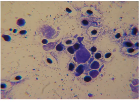 Figure 2. Microscopic evaluation (×100) of the kidney tissue to confirm the cause of morbidity