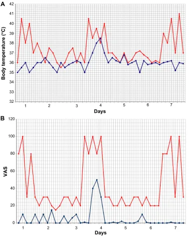 Figure 1 effect of canakinumab on thermal curves and its impact on Vas.Notes: (A) Thermal curves of the week preceding (red line) and the week following the administration of the first dose of canakinumab (blue line)