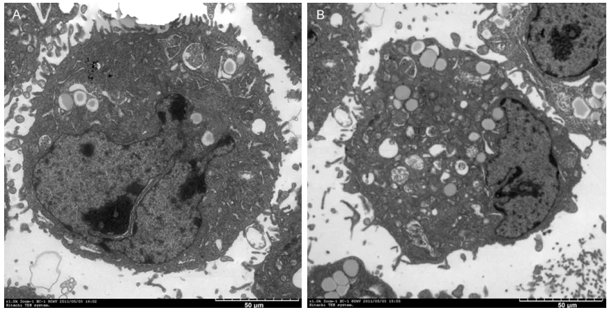 Figure 5. Antisense (AS-ODN3) and the control group were observed 24 hours after transfection of PC-3 cells in cell ultrastructure