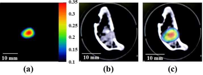 Figure 10. (a) MPI image of the MNFs (150 mM Fe) implanted in the bone of a chicken, (b) X-ray CT image of the bone implanted with MNFs, and (c) the fusion image between the MPI and X-ray CT images
