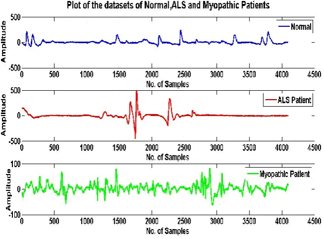 Fig. 1: EMG data pattern of a normal person, the ALS patient and the myopathic patient
