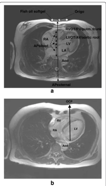 Fig. 1 a The internipple line (INL) image showing AP EXTERNAL and AP BLOOD (the sum of blood-filled structures along AP EXTERNAL .) Fish oil softgels identify the INL level