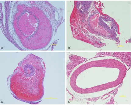 Figure 3. Hematoxylin & Eosin (H&E) staining of of aortic tissues from the 100 mg/kg AEEA group (A) and 150 mg/low-dose (100 mg/kg) AEEA group (A)