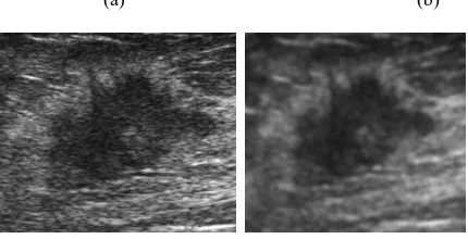 Fig. 2:  (a) Original ROI of ultrasound with spiculated Mass, (b) Image after Preprocessing 