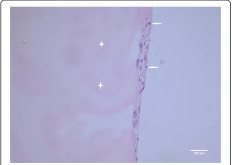 Fig. 4 a Particulated cartilage fragments (stained in brown to the right with S-100) digested overnight with collagenase solution and thereafterembedded in fibrin matrix (transparent in the middle), ×10 magnification