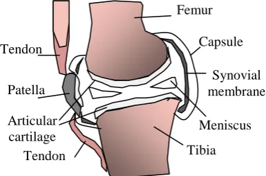 Fig.2 OA affected knee joint 