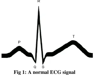 Fig 1: A normal ECG signal 