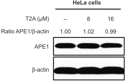 Figure S1 representative Western blot images showing aPe1 endogenous and Abbreviations:cancer cell line; aPe1exogenous protein levels in control (hela cells), aPe1shrna, aPe1wt, and aPe1c65s cells