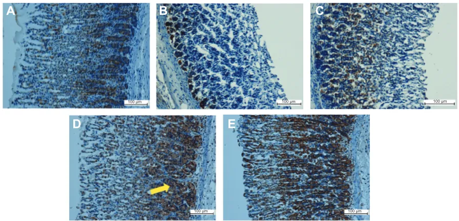 Figure 8 Immunohistochemical analysis of Bax protein expression from five groups of rats, namely: (A) normal control, (B) lesion control, (C) low dose of eeaM, (D) high dose of eeaM, and (E) omeprazole control