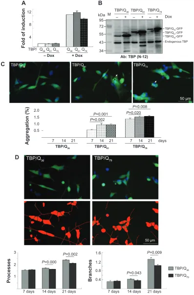 Figure 3 sh-sY5Y cells with induced TBP/Q36~79-gFP expression and neuronal phenotype. Notes: (A) Real-time polymerase chain reaction quantification (n=3) of TBP/Q36~79-gFP mrna level relative to hPrT1 mrna after 2 days of induction with doxycycline (+ Dox)