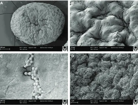 Figure 1 Optical microscopy of PB-sa and PB-Dca-sa microcapsules.Notes: (A) PB-sa microcapsules