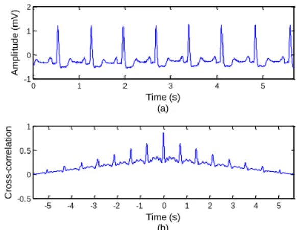 Figure 10. (a) Time domain representation of reconstructed  ECG signal, (b) cross correlation between original abnormal 