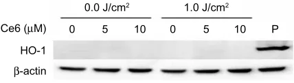 Figure 7 hO-1 expression induced by ce6 or ala-PDT.Notes: hucc-T1 cells were treated with 0.0, 5.0, or 10.0 µM ce6 for 90 minutes and irradiated with 1.0 J/cm2 light power