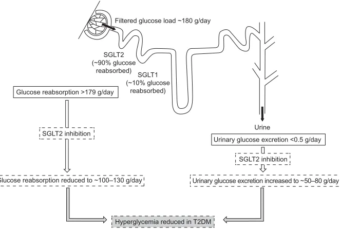 Figure 1 Renal tubular reabsorption of glucose.Notes: Most of the glucose in the glomerular filtrate is reabsorbed by SGLT2 in the proximal convoluted tubule and the remainder is reabsorbed by SGLT1 in the distal straight segment of the tubule, so virtuall