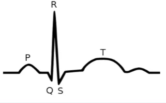 Figure 1. Electrocardiogram (ECG) wave features.     