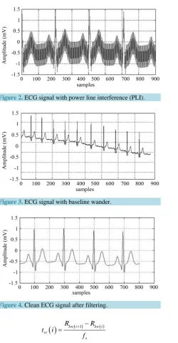 Figure 3. ECG signal with baseline wander.                   