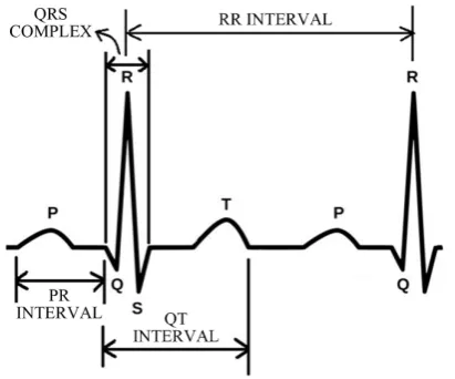 Figure 5. Intervals defined for PQRST wave.                     