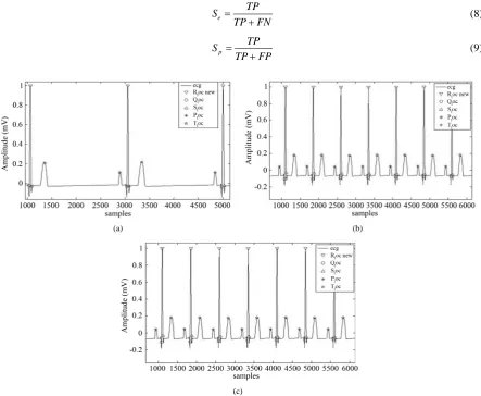 Figure 6. (a) Result at 30 BPM; (b) Result at 80 BPM; (c) Feature detection at 180 BPM