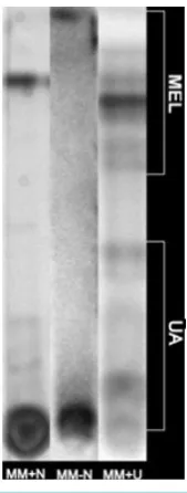 Figure 4. Total lipid concentration in cell extracts of U. maydis in the different media, taken at the fifth day of growth