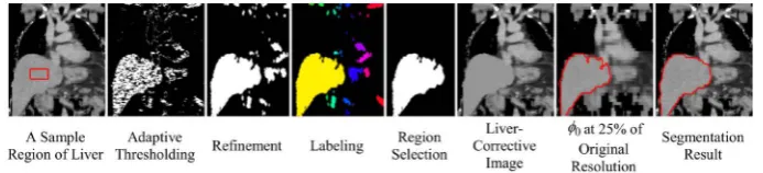 Figure 7. An example of some steps in creation of seed regions in axial images from coronal images