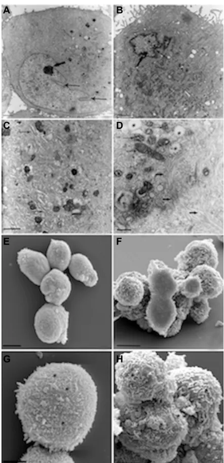 Figure 7 Morphologic analysis of stem cells derived from primitive fetal cells present 4,400untreated cells, 1,600in human amniotic fluid (hAFSCs) during HA + BU + ra-induced differentiation toward the cardiovascular phenotype