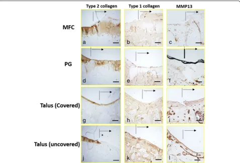 Fig. 7 Results of quantitative values of immunochemistry of type 2 collagen, type 1 collagen, and MMP13 in the osteochondral defect of themedial femoral condyle (MFC), patellar groove (PG), covered talus (C), and uncovered talus (UC)
