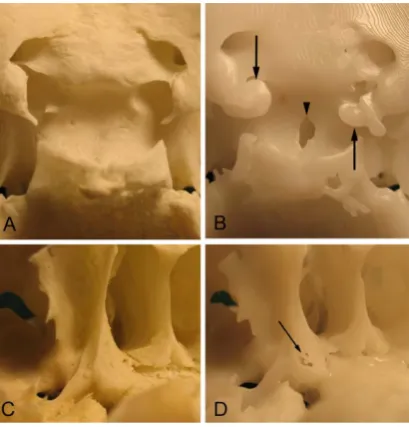 Figure 1. Examples of 3D printed models of a mandible compared to the original specimen