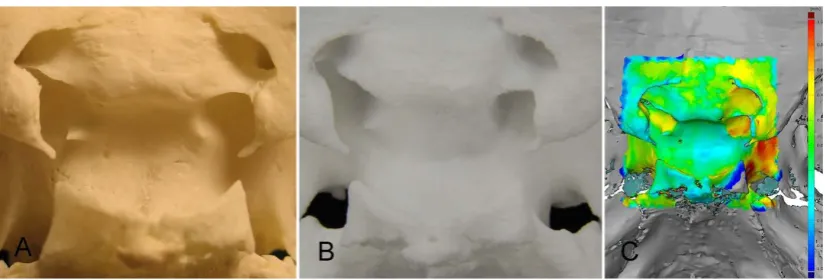 Figure 3. The impact of extensive manual editing of CT images on the quality of replicas