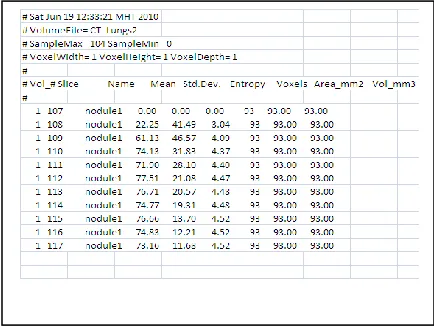 Fig 6 (a): Thresholding using Analyz Fig 6(b): Region filling using Analyze  