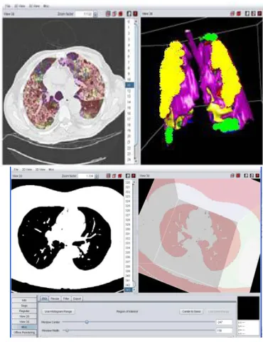 Fig 8 (a), (b): Lung segmentation from chest CT scan using  YaDiv 