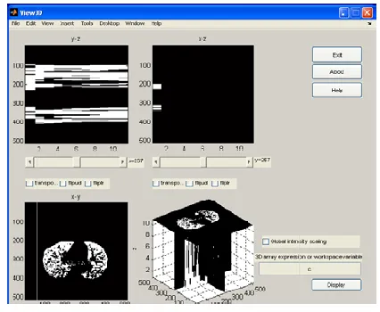 Fig 10: 3D view of MATITK results for ten slices.  
