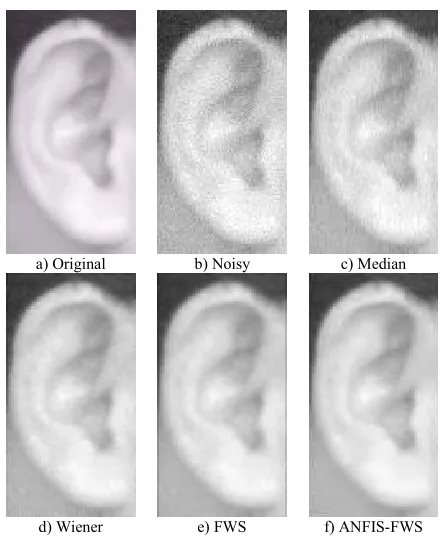 Figure 11. Comparison of the enhanced images of the 
