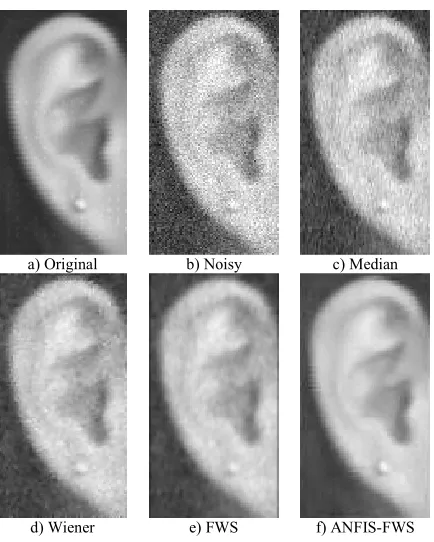 Table 4. Denoising algorithm accuracy for noisy and denoisy images by 10% noise. 