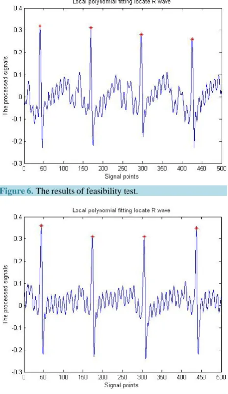Figure 7. Corresponding instantaneous heart rate chart.         