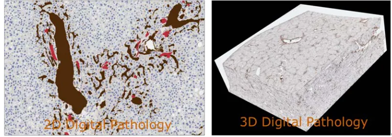 Figure 2: Pathology Imaging/Digital Pathology—Examples of 2-D and 3-D Pathology Images 