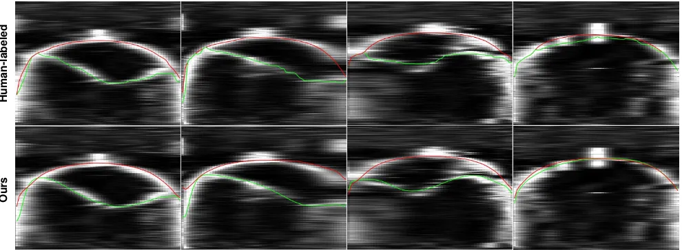 Figure 5. Visualization of sample tomographic images with height H and width W. The ﬁrst row shows the ice-air (red) and ice-bed(green) layers labeled by human annotator, while the second row shows the predicted layers by our model