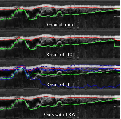Fig. 3.Results of the bedrock layer ﬁnding on a sampleechogram. In each image, the upper (red) boundary is the ice-air layer, and the lower (green) boundary is the ice-bottomlayer