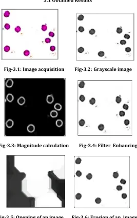 Fig-3.5: Opening of an image.      Fig-3.6: Erosion of an  image. 