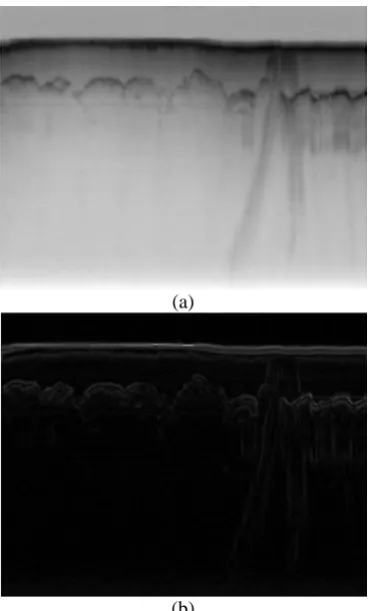 Figure 2: Horizontal projection profile for local vertical columns 