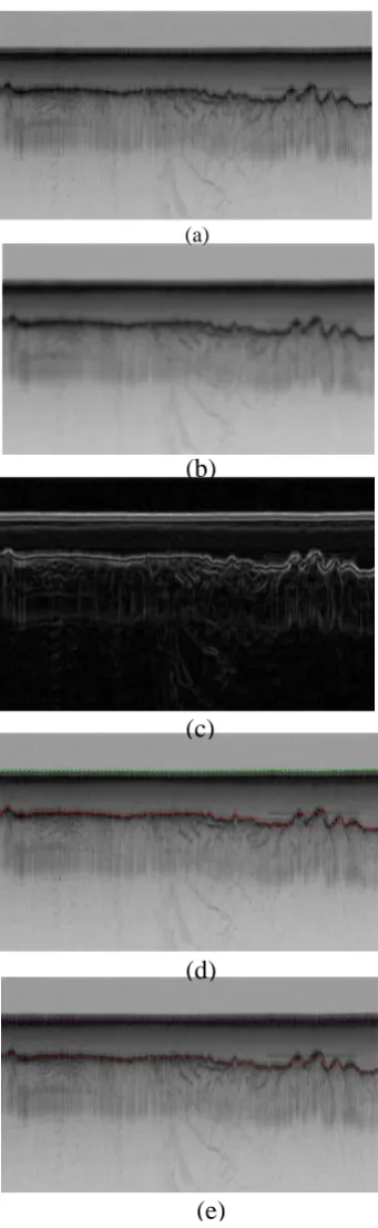 Figure 3: The result of our approach. a) original image, b) the enhanced image after anisotropic diffusion, c) truth detected contours with ElFi technique, d) detected ice surface and bottom after projection profile, e) ground- 